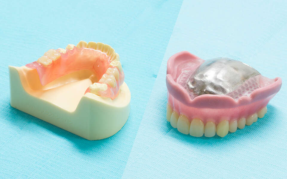 オーダーメイド義歯
