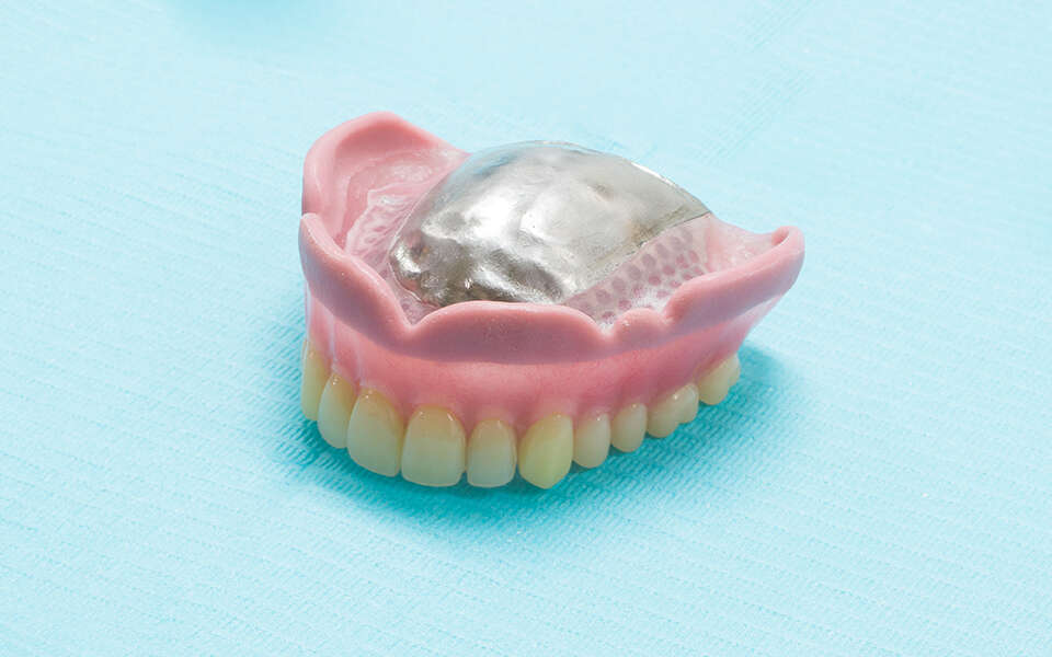 コンプリート義歯（総入れ歯）