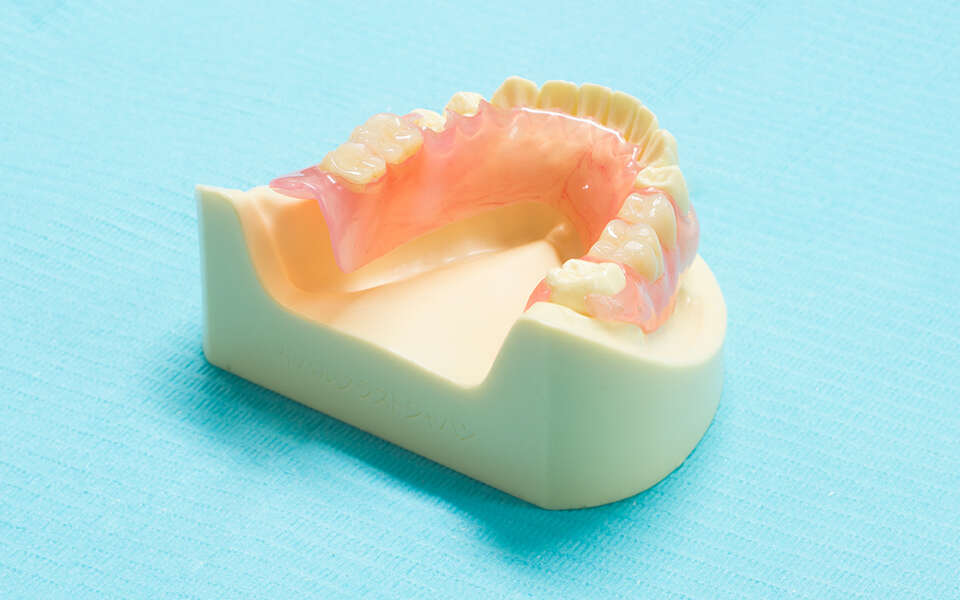 シリコン義歯（コンフォート義歯）