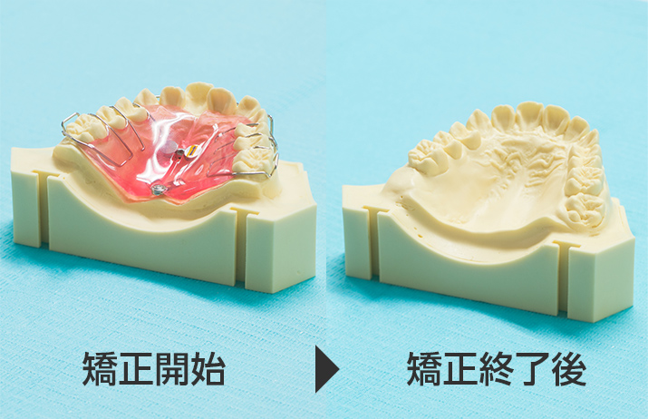 床装置